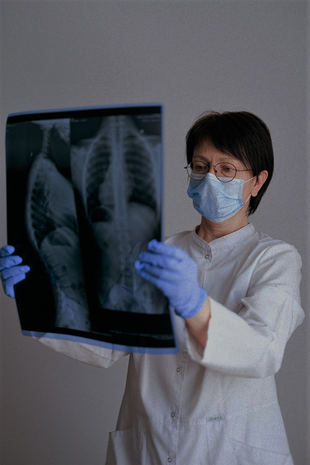 Doenças pulmonares vasculares e intersticiais